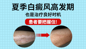 白癜风治疗费用一般多少钱