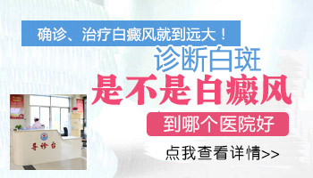 老公身上有白点是什么 男性长白点怎么回事