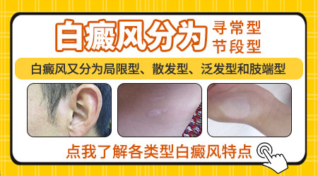 白癜风症状图 不同类型白癜风表现