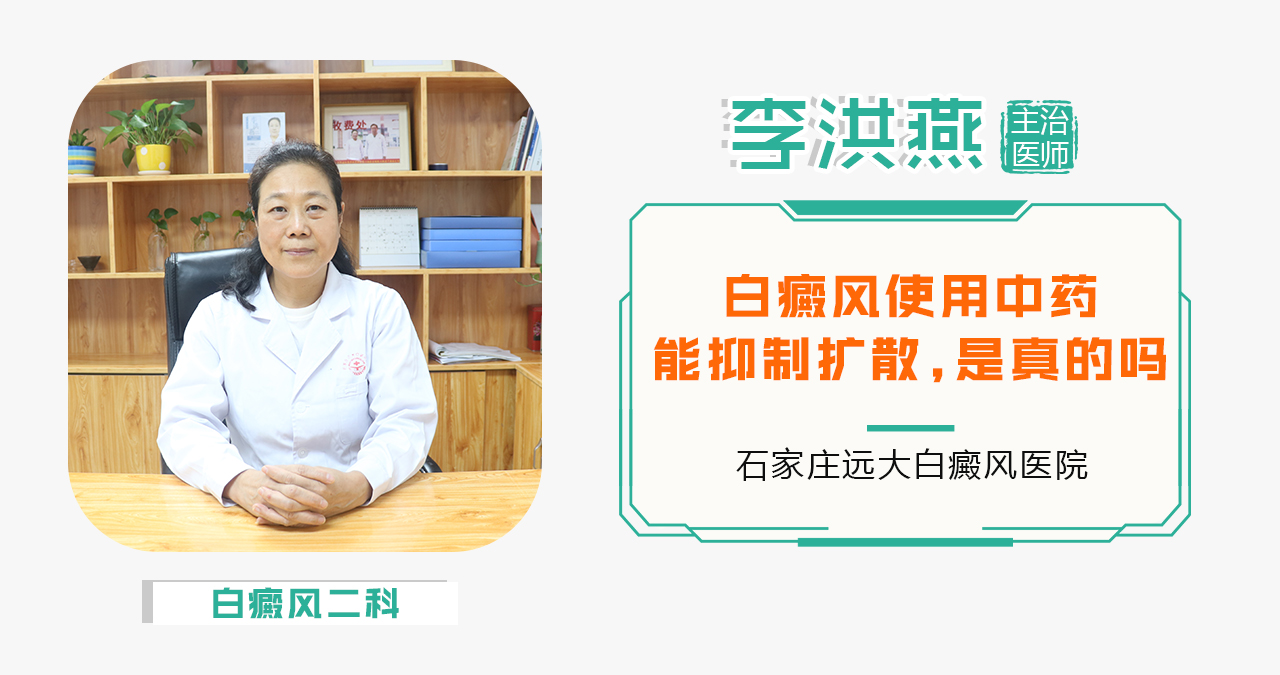 白癜风使用中药能抑制扩散，是真的吗