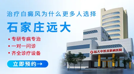 白癜风不治疗会不会扩散到全身