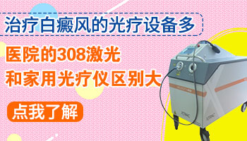 自己买的308照白癜风有效果吗