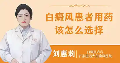 白癜风患者用药该怎么选择