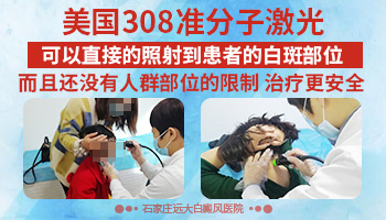 西格玛的308光疗仪和医院的308有什么区别