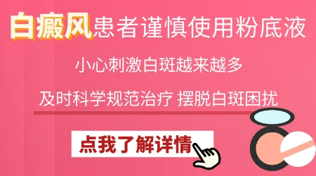 白癜风能不能用粉底遮盖