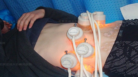 白癜风的治疗费用