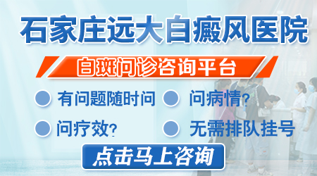 白癜风照激光能照好吗