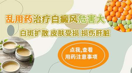儿童白斑用什么药膏
