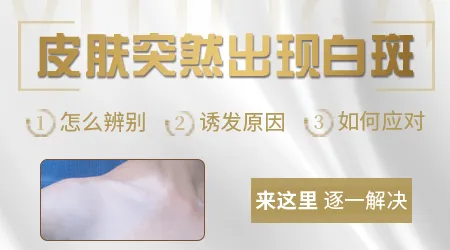 胳膊上乳白色的斑块是白癜风吗
