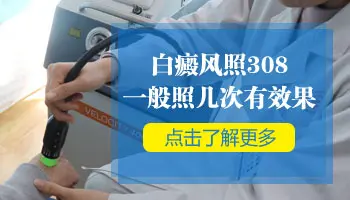 手指尖白斑照308准分子激光照多少秒才有效果