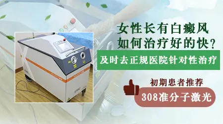 如何治疗女性颜部白癜风比较快