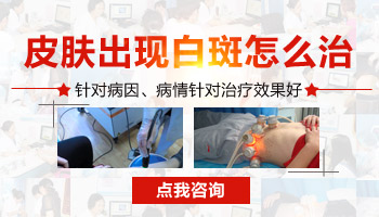 乳头对称白癜风怎么治疗好