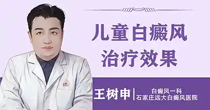 儿童白癜风治疗效果