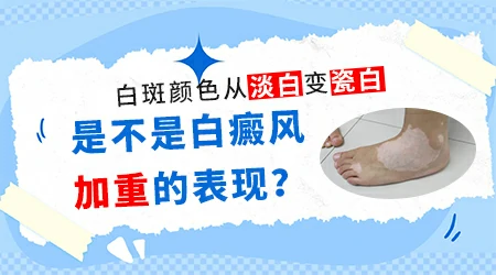 白癜风的白斑颜色变化代表什么