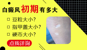 21岁女孩身上有个豆粒大白斑是什么