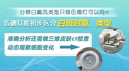 伍德灯能判断白斑在进展还是稳定吗