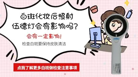 化妆后去照射伍德灯有影响吗