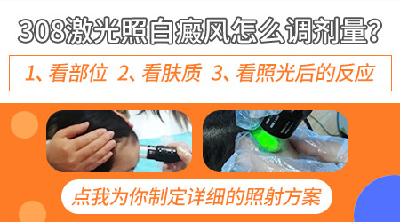 白斑照308光后红肿好不好