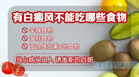 经常使用铜制餐具等物对白癜风康复有帮助吗？