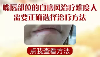 为什么口唇的白癜风难治愈
