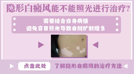 隐形白斑照了308的位置会变成什么样