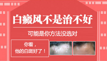 为什么白癜风越治越白了