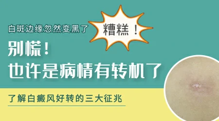 白斑边缘颜色变深是好转还是加重?一文看懂"色素岛