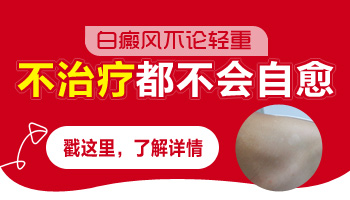 白斑会自己消失吗 如何治疗白癜风