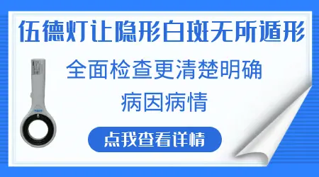 伍德灯照出的隐形白斑代表病情加重吗