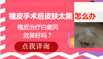 黑色素移植后白斑很黑怎么恢复