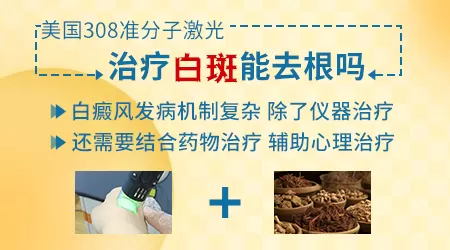 额头边际线长白斑