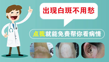 腿上有小小旳白点慢慢变大是白癜风吗