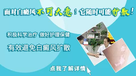 辨别白癜风的常见方法有哪些