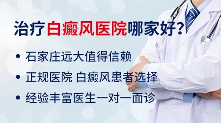 白癜风UVB灯有用吗