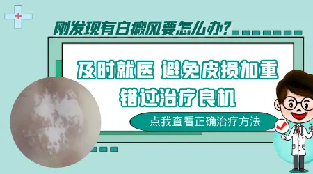 手上刚出现的白斑好治疗吗