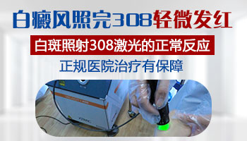 如何判断白癜风照308发红有没有效果