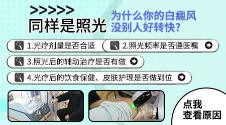 白癜风照光不见好是为什么