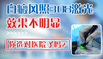 白癜风照308要照多少分钟