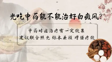 白癜风只喝中药能不能治好