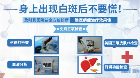 白斑是白癜风吗 如何诊断白癜风