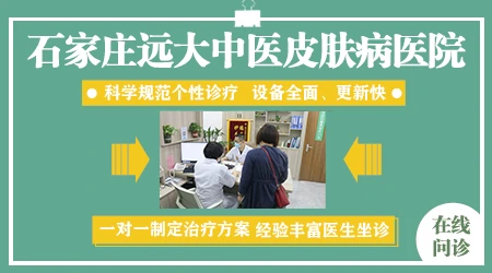 石家庄哪个白癜风专科医院效果好