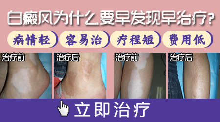 身上出现白点像是白癜风怎么确诊是不是