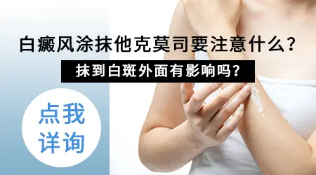 他克莫司治白癜风的功效怎么样