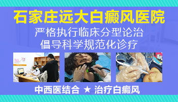 早期白癜风照308激光多久出现效果