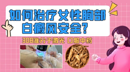 女性胸口光滑的白斑像是白癜风