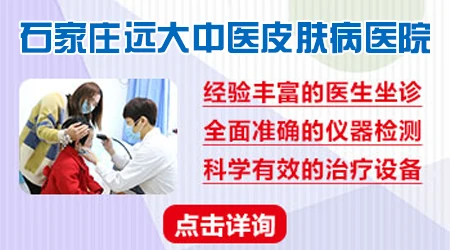 石家庄白癜风去哪个医院治疗好