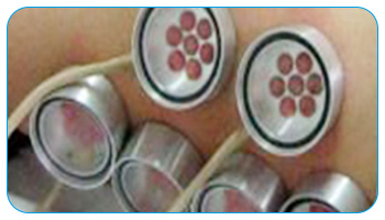 黑色素细胞种植白斑的效果怎么样 和植皮有什么区别