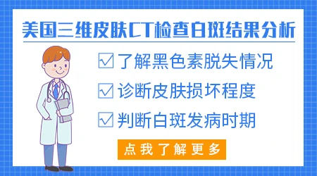 伍德灯照出白斑是不是就确诊白癜风了