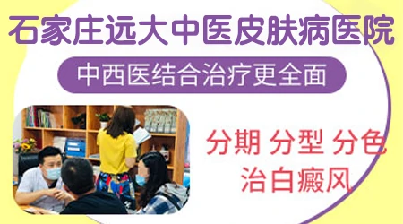 石家庄中西医结合治白癜风哪个医院好