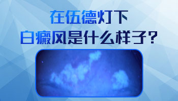 伍德灯下白块显示亮白色是白癜风吗